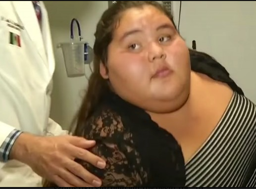 Μπήκε στο χειρουργείο ως η πιο παχύσαρκη έφηβη του κόσμου. 9 μήνες αργότερα - Δείτε πώς είναι σήμερα... - Φωτογραφία 1