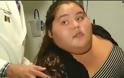 Μπήκε στο χειρουργείο ως η πιο παχύσαρκη έφηβη του κόσμου. 9 μήνες αργότερα - Δείτε πώς είναι σήμερα...