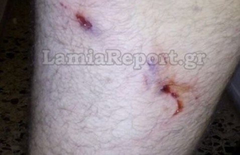 Στυλίδα: Επίθεση αδέσποτων σε 34χρονο στο Μαρίνι - Φωτογραφία 1