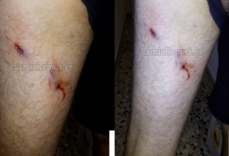 Στυλίδα: Επίθεση αδέσποτων σε 34χρονο στο Μαρίνι - Φωτογραφία 2