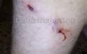 Στυλίδα: Επίθεση αδέσποτων σε 34χρονο στο Μαρίνι