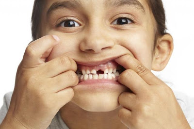 Οι επτά κακές συνήθειες που κάνουμε και χαλάνε τα δόντια μας - Φωτογραφία 1