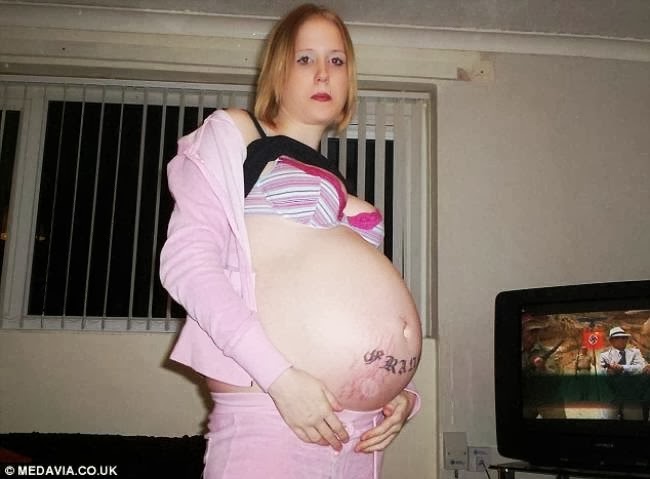 Κι όμως αυτή η γυναίκα δεν είναι έγκυος – Δείτε τι έχει... - Φωτογραφία 1