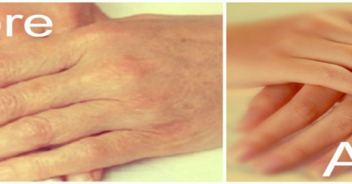 Απίστευτη συνταγή για να προστατέψετε τα χέρια σας από τα σημάδια της γήρανσης - Φωτογραφία 1