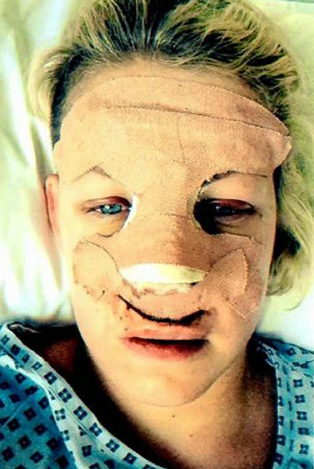 Σοκάρουν οι εικόνες της 28χρονης Sasha Jenkins, μετά τον ξυλοδαρμό που υπέστη! [photos] - Φωτογραφία 2