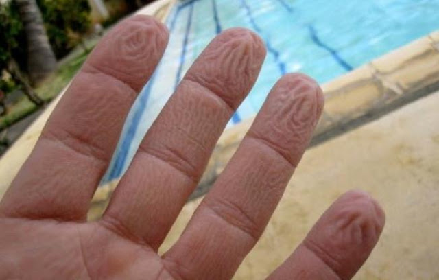 Γιατί ζαρώνουν τα δάχτυλά μας μέσα στο νερό – Όχι, δεν είναι επειδή «μούλιασαν» - Φωτογραφία 1
