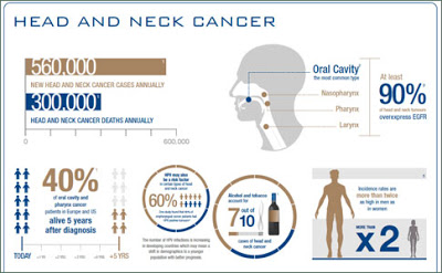 Προσέξτε τα συμπτώματα του Καρκίνου Κεφαλής και Τραχήλου. Ποιοι οι παράγοντες κινδύνου; - Φωτογραφία 2