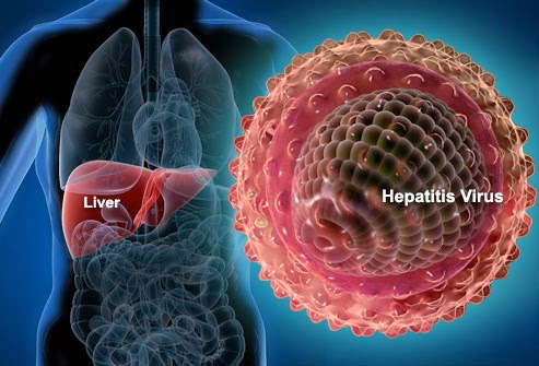 Ηπατίτιδα. Τι είναι, πώς μεταδίδεται, πώς προλαμβάνεται και ποια ηπατίτιδα θεραπεύεται πλήρως; - Φωτογραφία 2