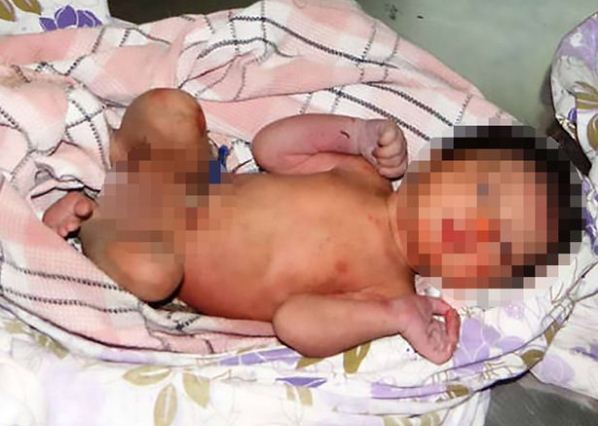Εικόνες σοκ:Πέταξαν νεογέννητο κοριτσάκι σε θάμνο με αγκάθια για να πεθάνει - Φωτογραφία 2