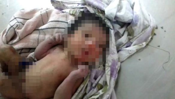 Εικόνες σοκ:Πέταξαν νεογέννητο κοριτσάκι σε θάμνο με αγκάθια για να πεθάνει - Φωτογραφία 3