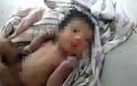 Εικόνες σοκ:Πέταξαν νεογέννητο κοριτσάκι σε θάμνο με αγκάθια για να πεθάνει - Φωτογραφία 3
