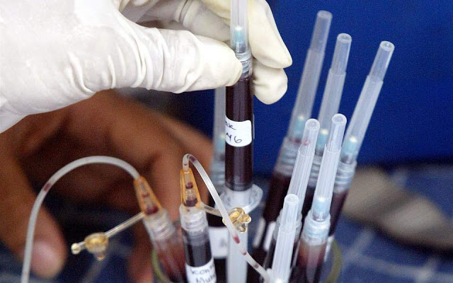 ΗΠΑ-Νέο πρωτοποριακό Τεστ αίματος για ταχεία διάγνωση καρκίνου - Φωτογραφία 1