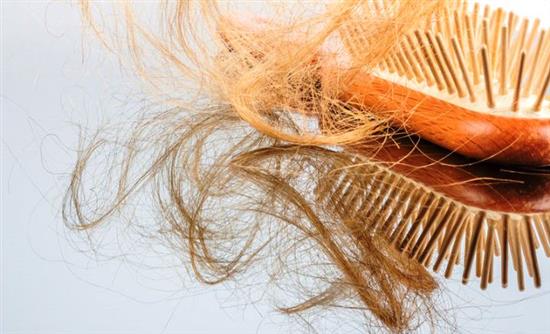 Απώλεια μαλλιών: Τρεις φυσικές θεραπείες - Φωτογραφία 1