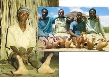 Φυλή Vadoma: Οι άνθρωποι με τα πόδια που θυμίζουν στρουθοκάμηλο (φωτό, βίντεο) - Φωτογραφία 4
