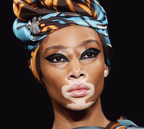 H Winnie Harlow εξομολογείται ότι δεν ήθελε να γίνει μοντέλο σε συγκινητικό instagram post - Φωτογραφία 2