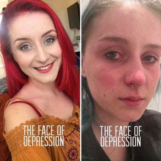 Το πρόσωπο της κατάθλιψης και τα στερεότυπα - Φωτογραφία 2