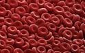 Ερυθρά αιμοσφαίρια: Πώς θα τα αυξήσουμε;