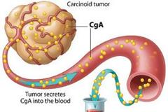 Xρωμογρανίνη, ειδική εξέταση για καρκίνους του ενδοκρινικού και νευρικού συστήματος, του προστάτη και του πνεύμονος