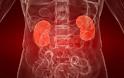 Πυελονεφρίτιδα: Τι να προσέχετε κατά την ούρηση