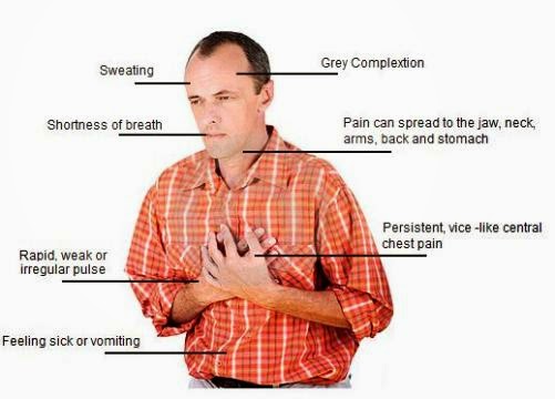 Συμπτώματα που προειδοποιούν για καρδιακή ανακοπή. Ο πόνος στο στήθος μπορεί να είναι από την καρδιά; - Φωτογραφία 2