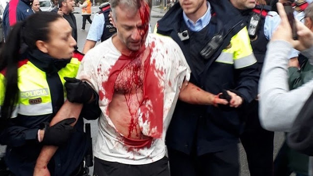 Σκηνές βίας στο δημοψήφισμα της Καταλονίας - Φωτογραφία 1