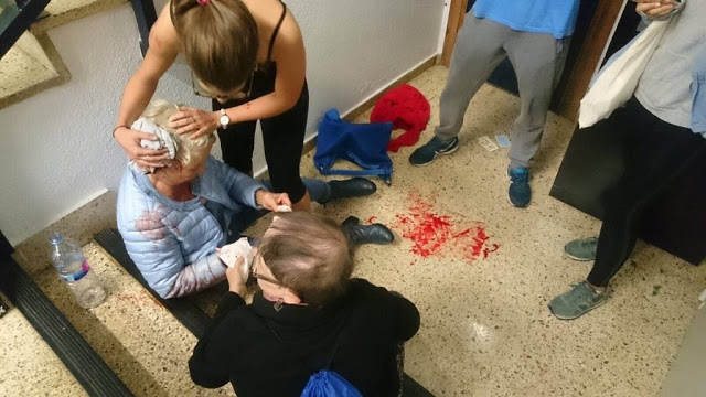 Σκηνές βίας στο δημοψήφισμα της Καταλονίας - Φωτογραφία 11