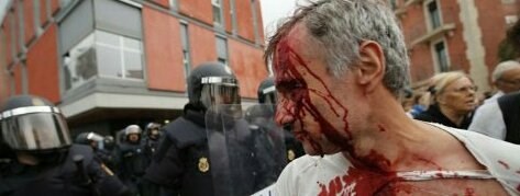 Σκηνές βίας στο δημοψήφισμα της Καταλονίας - Φωτογραφία 3