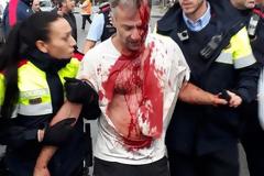 Σκηνές βίας στο δημοψήφισμα της Καταλονίας