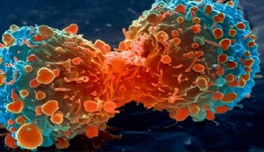Τι καταπολεμά καρκίνο, αλτσχάιμερ, καρδιαγγειακά, Πάρκινσον - Φωτογραφία 1