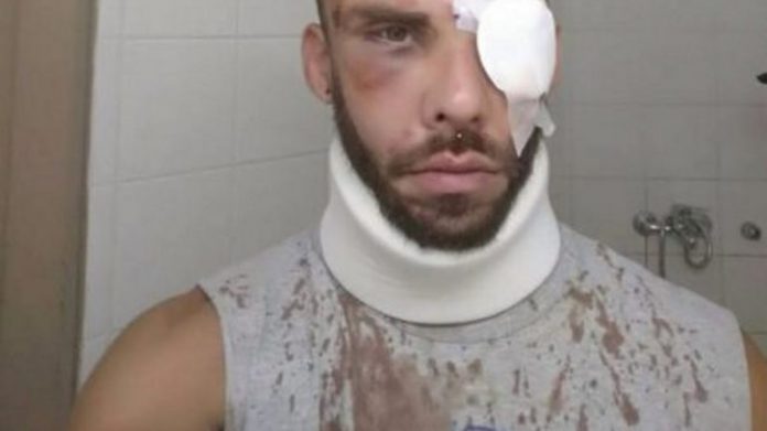 Μεγάλη ανατροπή: Δεν ξυλοκοπήθηκε από ντόπιους ο 30χρονος φοιτητής στο Ρέθυμνο - Φωτογραφία 1