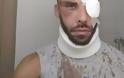 Μεγάλη ανατροπή: Δεν ξυλοκοπήθηκε από ντόπιους ο 30χρονος φοιτητής στο Ρέθυμνο