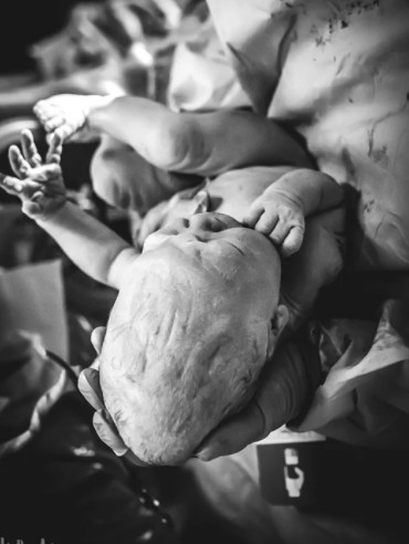 Όταν είδε το κεφάλι του νεογέννητου μωρού της, έπαθε το μεγαλύτερο σοκ της ζωής της...Λύγισε - Φωτογραφία 2