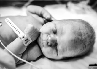 Όταν είδε το κεφάλι του νεογέννητου μωρού της, έπαθε το μεγαλύτερο σοκ της ζωής της...Λύγισε - Φωτογραφία 3