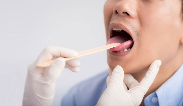 Συνήθη συμπτώματα που μπορεί να συνδέονται με τον καρκίνο του στόματος - Φωτογραφία 2