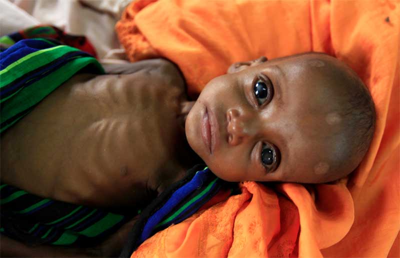 Ο ΟΗΕ προειδοποιεί για μεγάλο λιμό με εκατομμύρια θύματα στην Υεμένη - Φωτογραφία 1