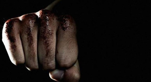 Καταγγελία-σοκ για bullying στο Ηράκλειο: Έστειλαν 13χρονο στο χειρουργείο,Παραλίγο να πεθάνει από χτύπημα «νταή» [Βίντεο]! - Φωτογραφία 1