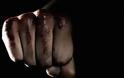 Καταγγελία-σοκ για bullying στο Ηράκλειο: Έστειλαν 13χρονο στο χειρουργείο,Παραλίγο να πεθάνει από χτύπημα «νταή» [Βίντεο]!