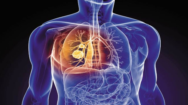 Η Χρόνια Αποφρακτική Πνευμονοπάθεια,αποτελεί την 5η αιτία θανάτου παγκοσμίως. - Φωτογραφία 1