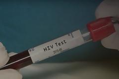 Κρήτη:Πώς διαμορφώνεται ο “χάρτης” του AIDS στην Κρήτη