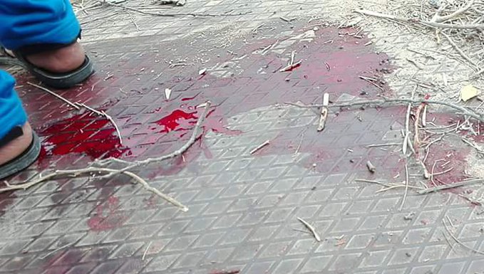 Παγκόσμιο σοκ από το μακελειό στο Βόρειο Σινά - Εκατοντάδες νεκροί και τραυματίες - Φωτογραφία 14