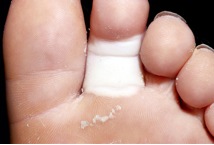 18 προβλήματα των ποδιών μας, που μας προειδοποιούν για τη συνολική μας υγεία - Φωτογραφία 4