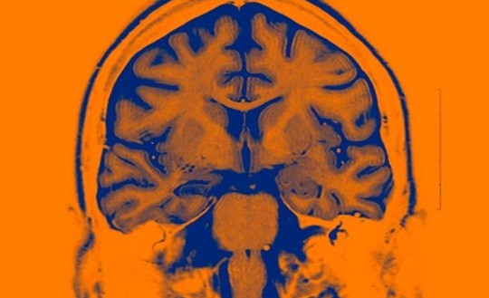 Υπό κλινική δοκιμή τα πρώτα εγκεφαλικά εμφυτεύματα τεχνητής νοημοσύνης - Φωτογραφία 1