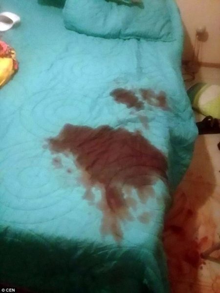 Προσοχή - Σκληρές εικόνες: 26χρονη ξύπνησε δίπλα στον σύντροφό της, πήρε το κλαδευτήρι και του έκοψε το… - Φωτογραφία 3