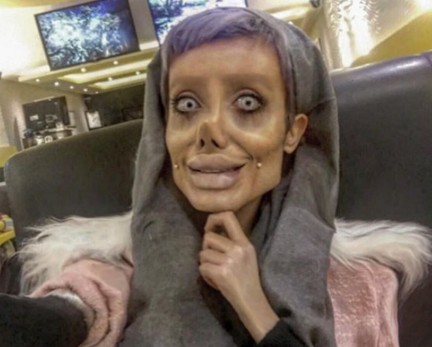 Ιρανή έκανε 50 πλαστικές για να μοιάσει στην Jolie και το αποτέλεσμα είναι τρομακτικό [photos] - Φωτογραφία 3
