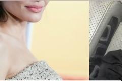 Ιρανή έκανε 50 πλαστικές για να μοιάσει στην Jolie και το αποτέλεσμα είναι τρομακτικό [photos]
