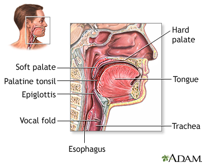 Φαρυγγίτιδα: Τι συμβαίνει στον λαιμό σας και πώς περνάει γρήγορα - Φωτογραφία 2