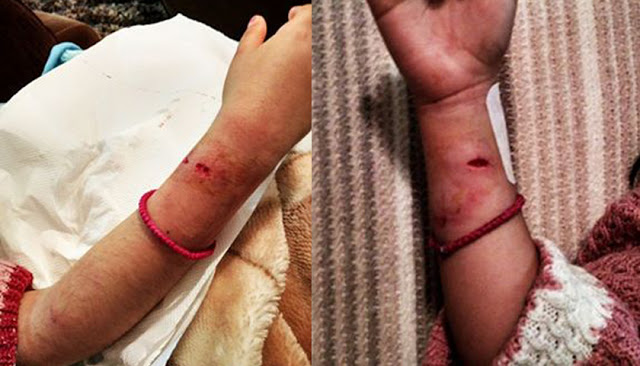 Μυτιλήνη: Επίθεση από αδέσποτα σκυλιά σε 7χρονο κοριτσάκι στο «Χριστουγεννιάτικο Χωριό» - Φωτογραφία 1