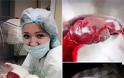 Ρωσία: Νοσοκόμες βγάζουν «αστείες» selfies με ανήμπορους ασθενείς - Φωτογραφία 4