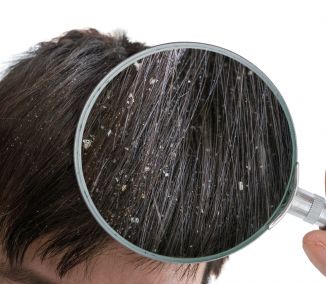 Τι μπορούν να αποκαλύψουν τα μαλλιά σας για την υγεία σας; - Φωτογραφία 2