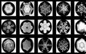 Οι πρώτες φωτογραφίες χιονονιφάδων από τον “Snowflake” Bentley - Φωτογραφία 2